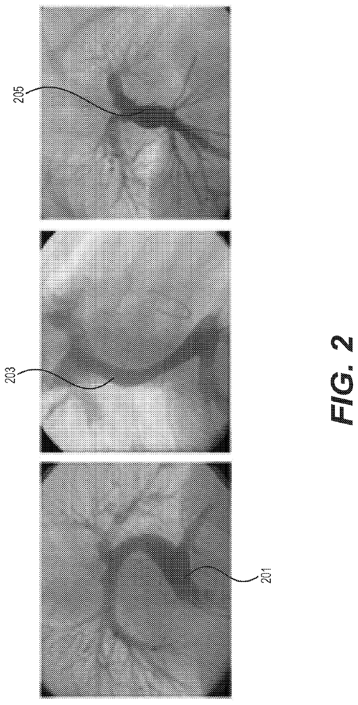 Method for generating an electro spun fiber medical implant