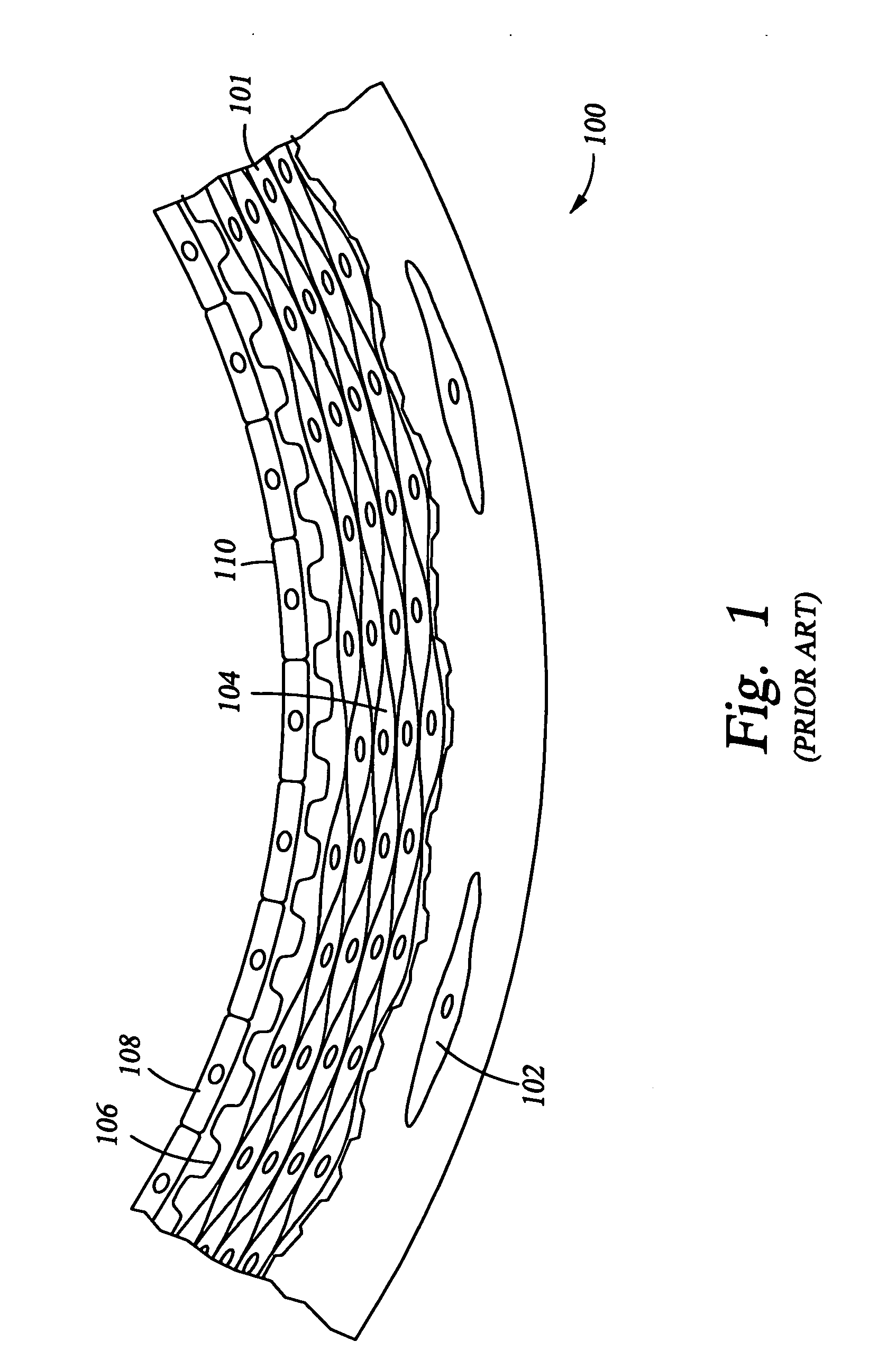 Apparatus and method for improving blood flow in arterioles and capillaries