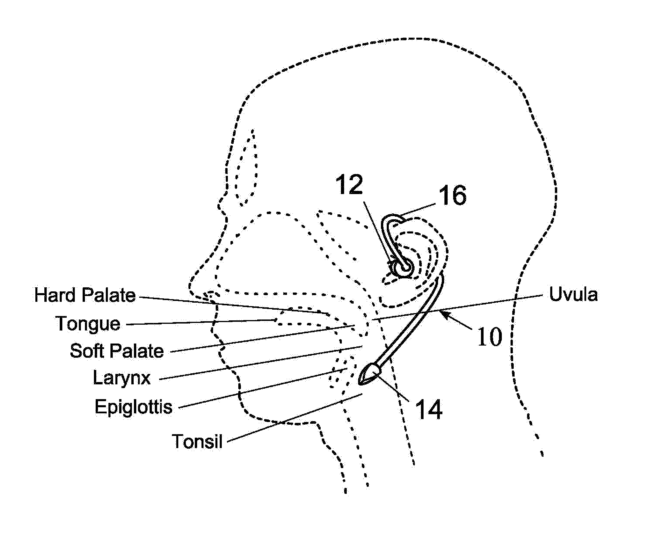 Device for the treatment of sleep-related conditions