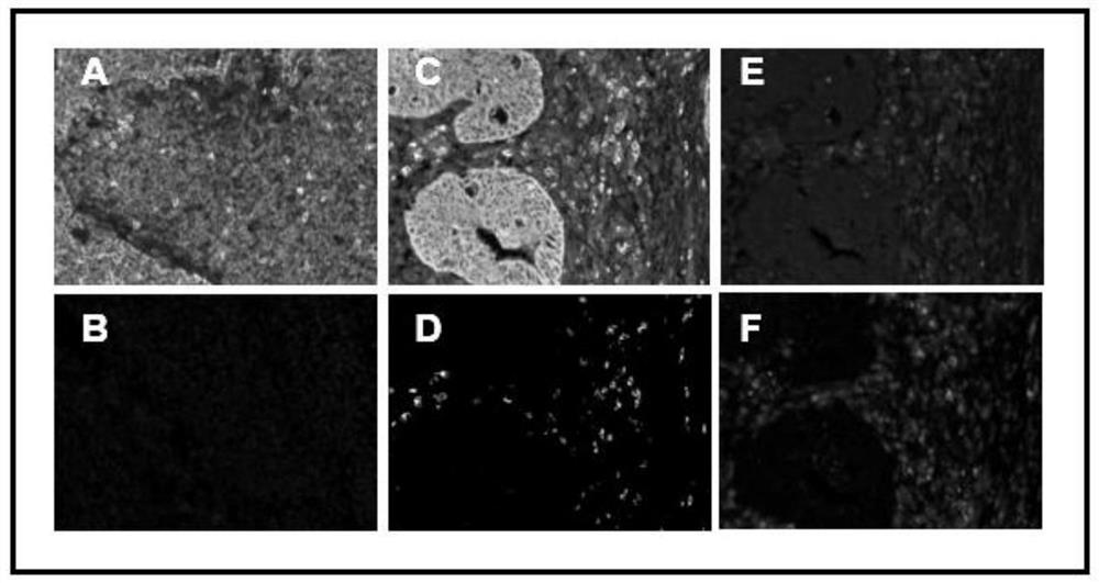 Preparation and application of tumor immune microenvironment regulating agent