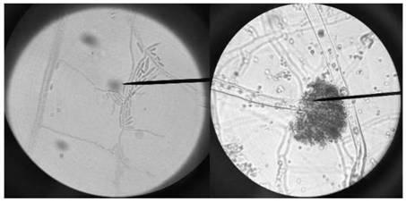 Biocontrol fungus identification method of soft rot diseases of boilen taros