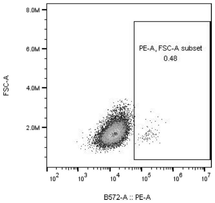 Fusion protein, recombinant vector, recombinant dendritic cell for transmembrane expression of novel coronavirus antigen S2, and application thereof