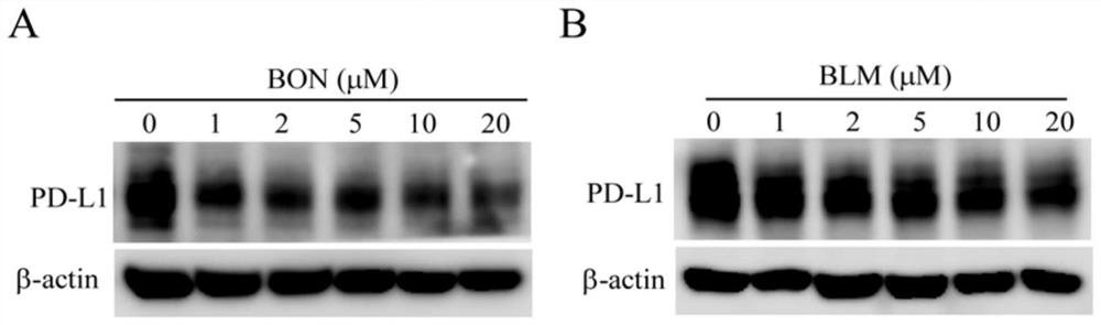 Application of bleomycin in inhibition of PD-L1 high-expression tumors