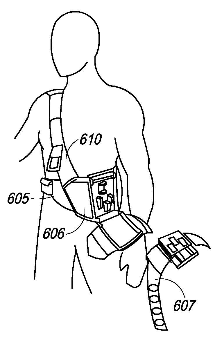 Wearable dialysis methods and devices