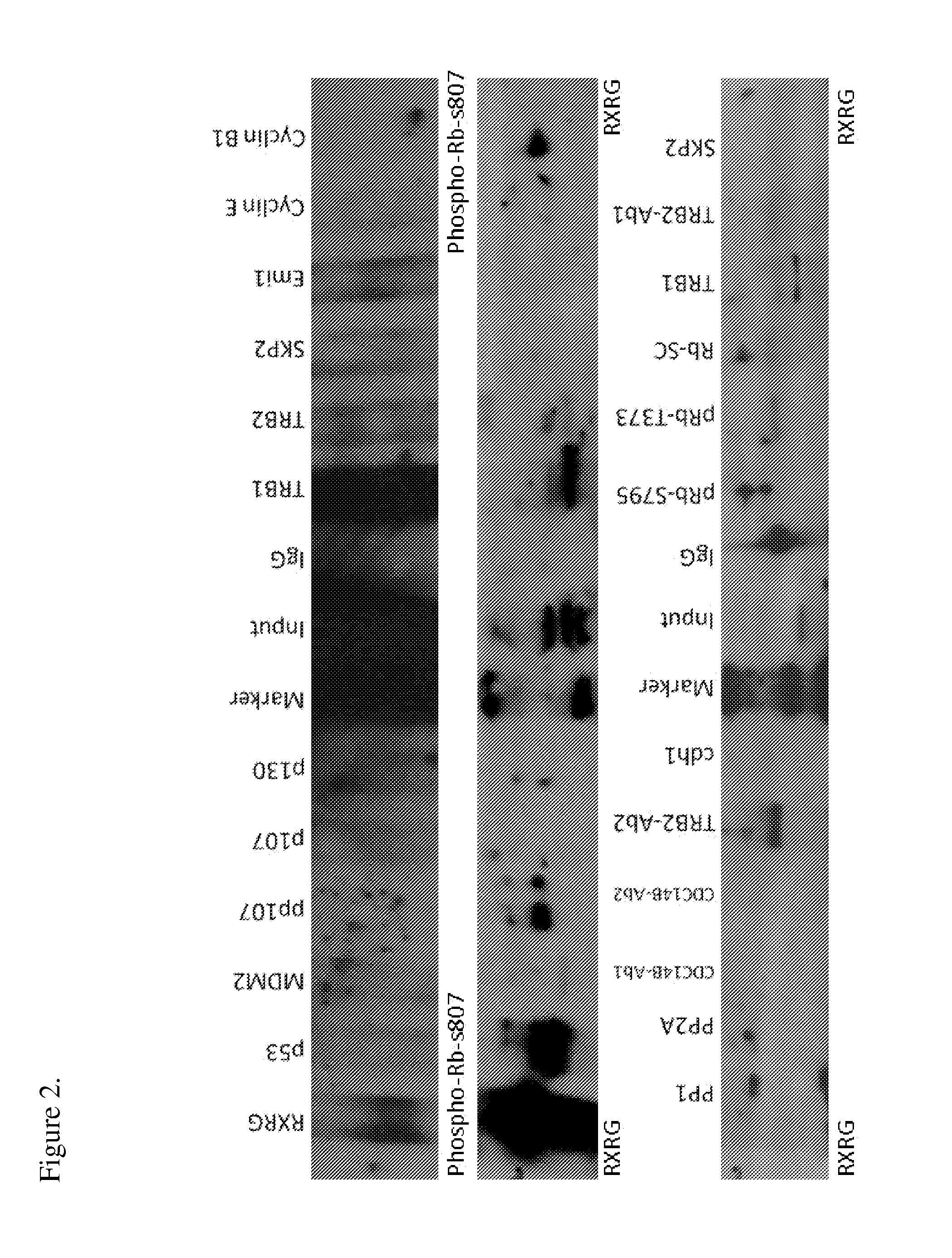 Rxrg modulators for the treatment of cancer
