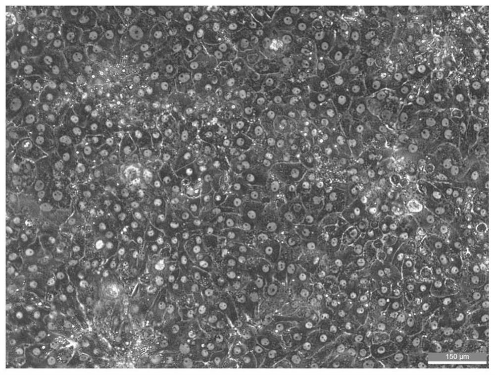 A method for establishing a hepatitis B virus-infected cell model using primary pig hepatocytes and hntcp recombinant lentivirus