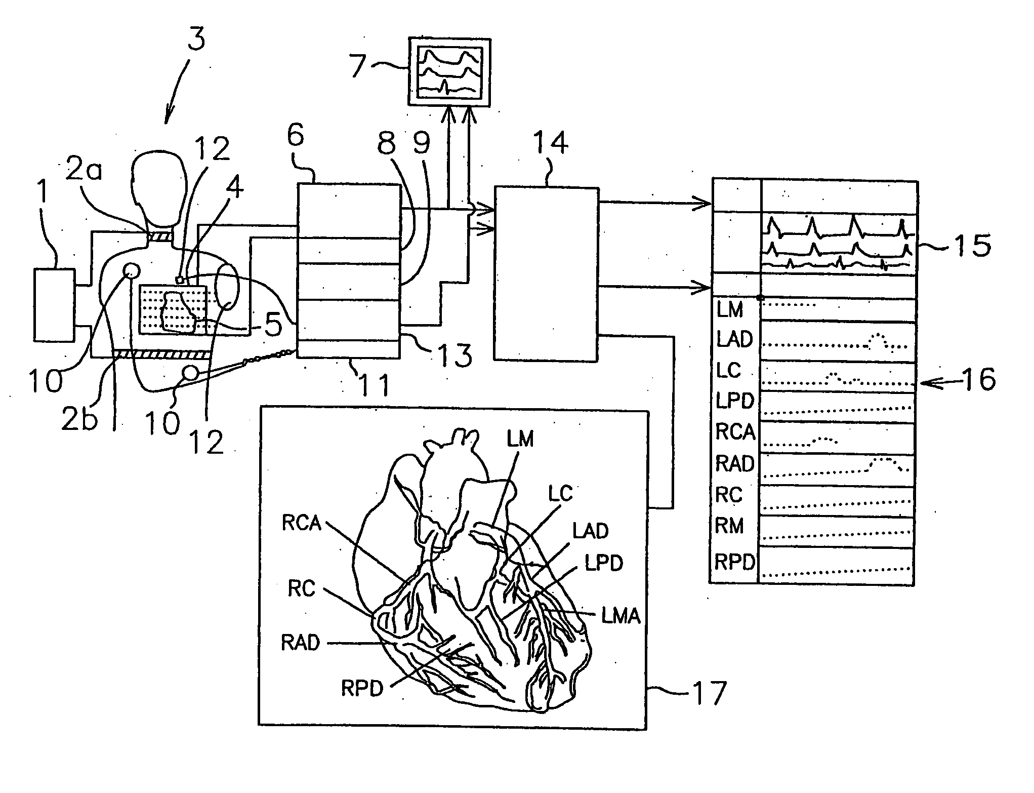 Stenosis detection device