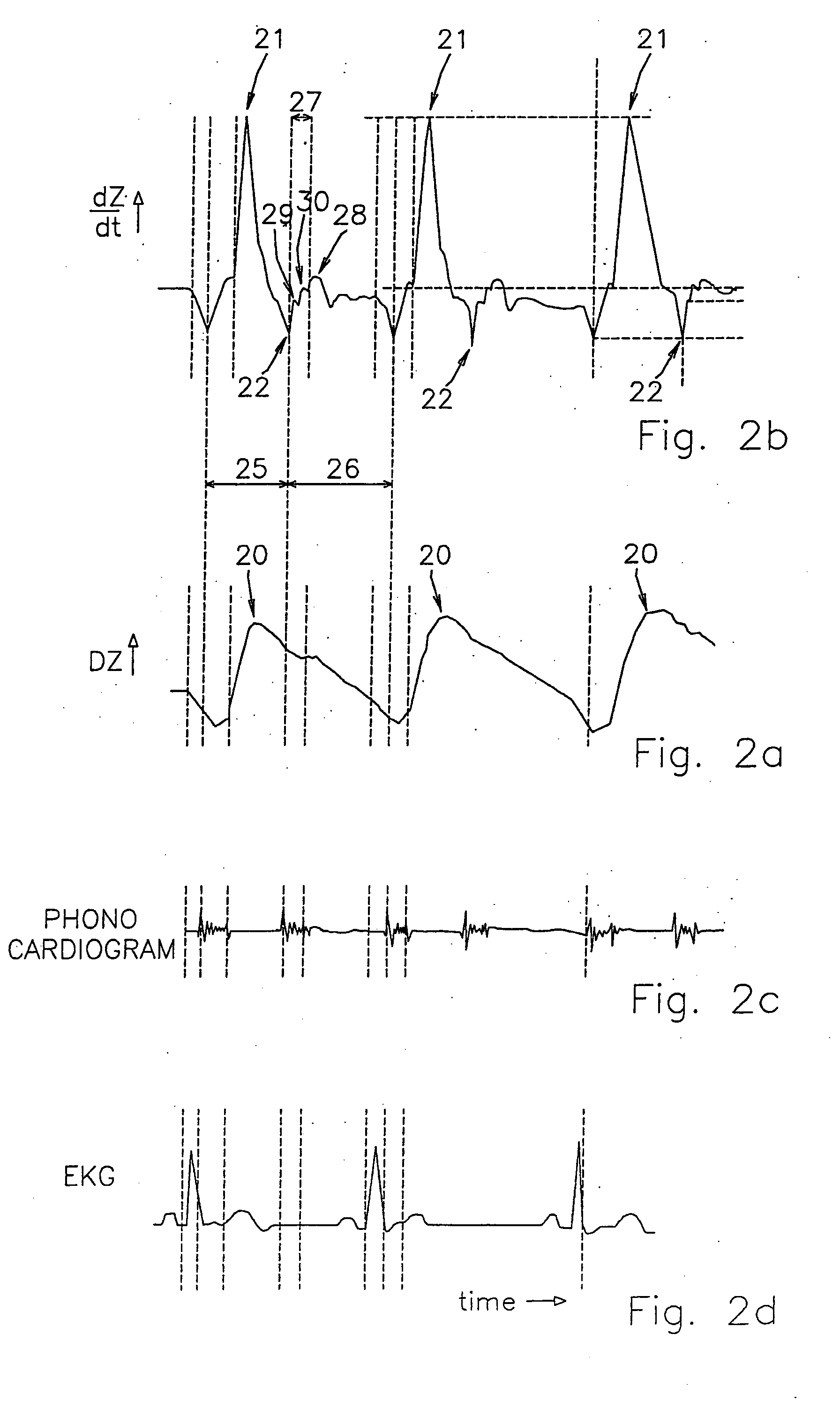 Stenosis detection device