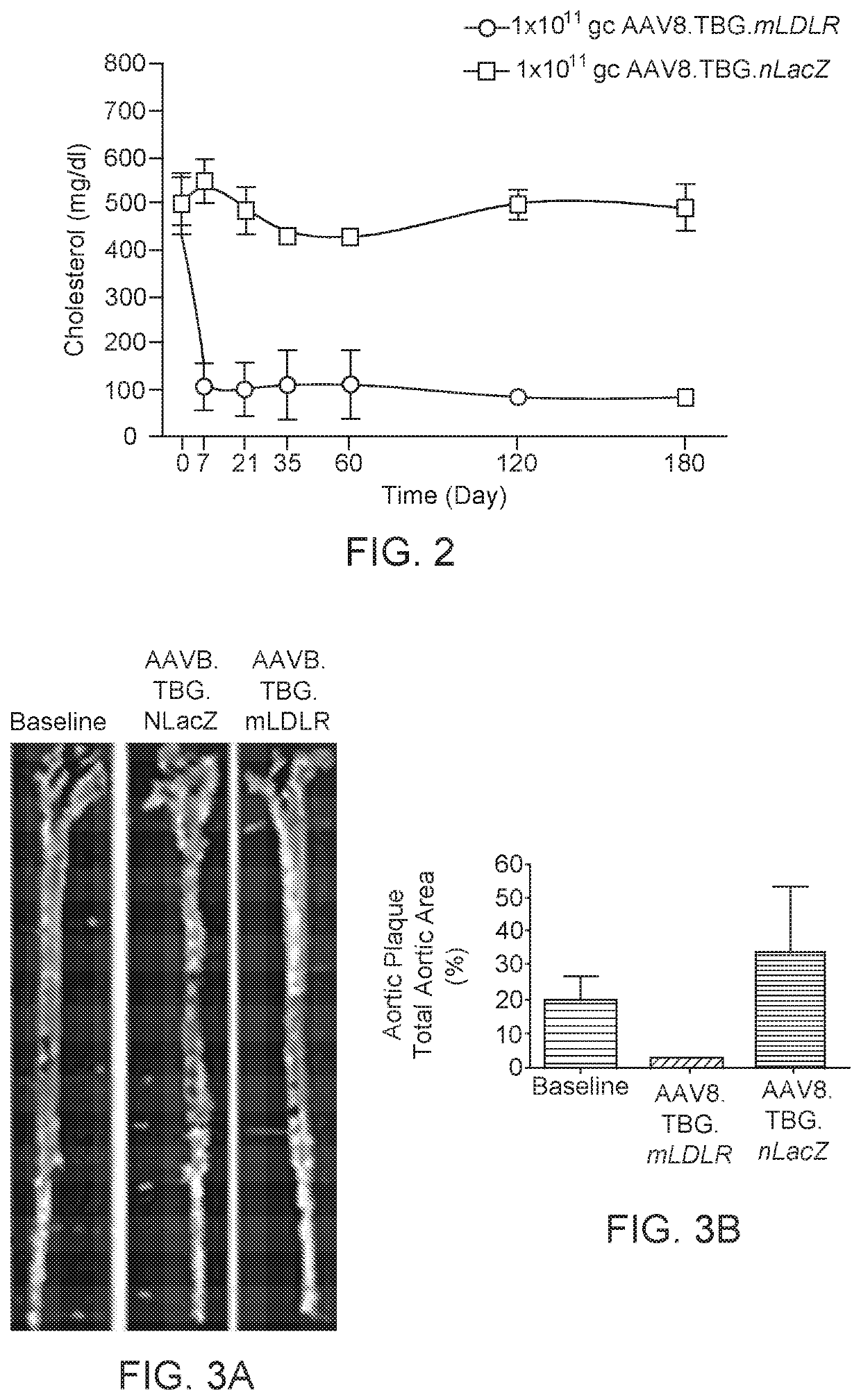 Gene therapy for treating familial hypercholesterolemia