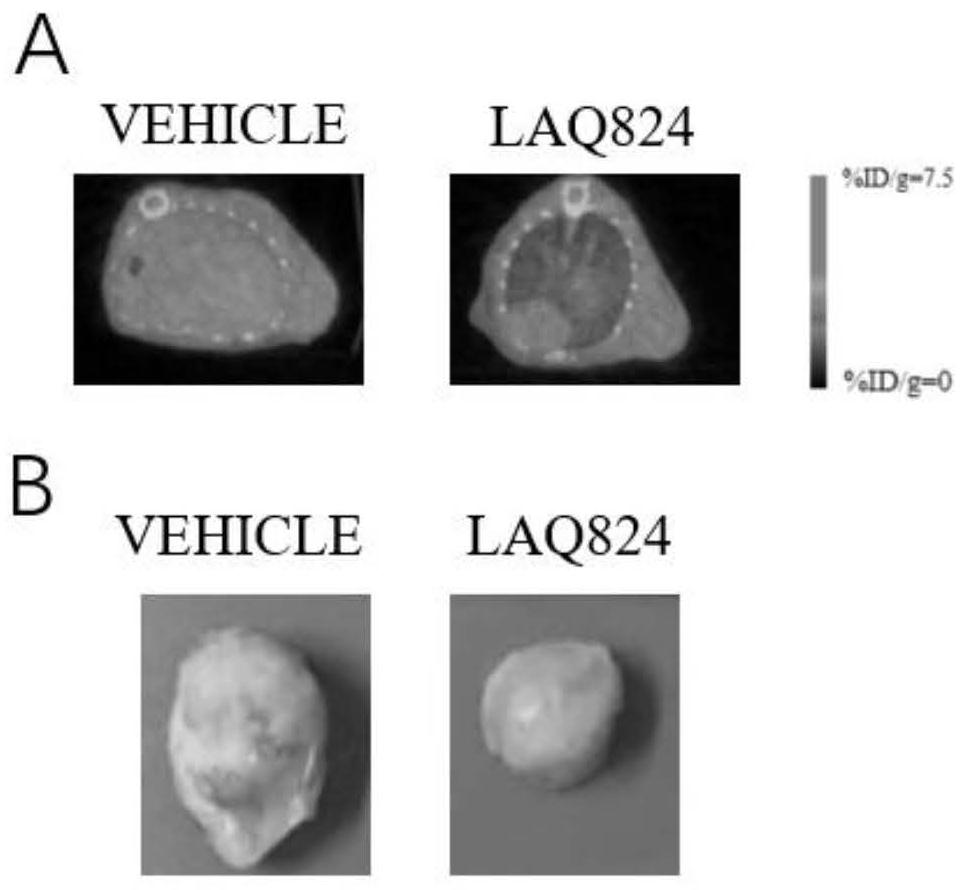 Application of novel HDAC inhibitor LAQ824 to drug for treating diffuse largeB-cell lymphoma