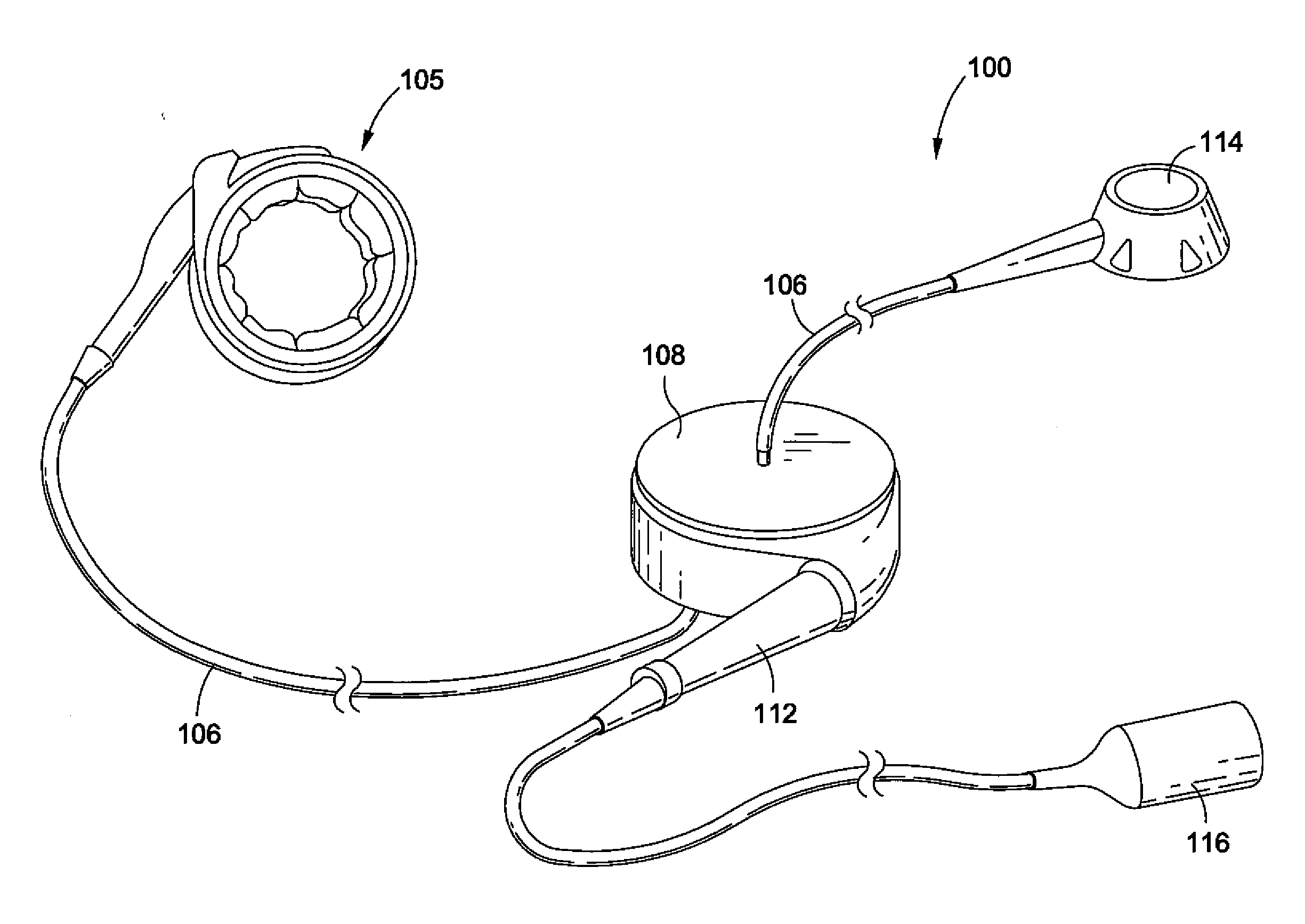 Remotely adjustable gastric banding system