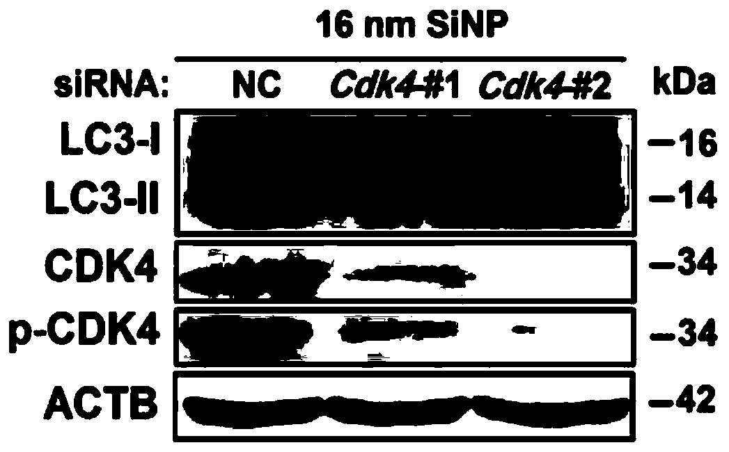 Method for identifying functional kinase for regulating cell autophagy