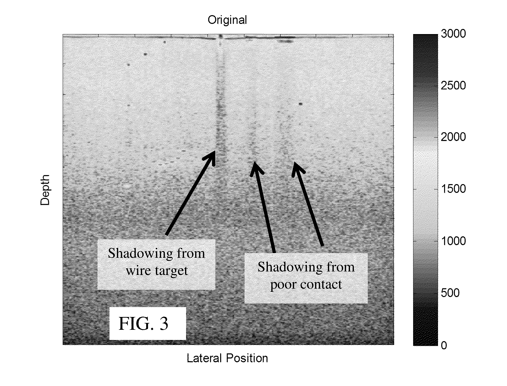 Shadow suppression in ultrasound imaging