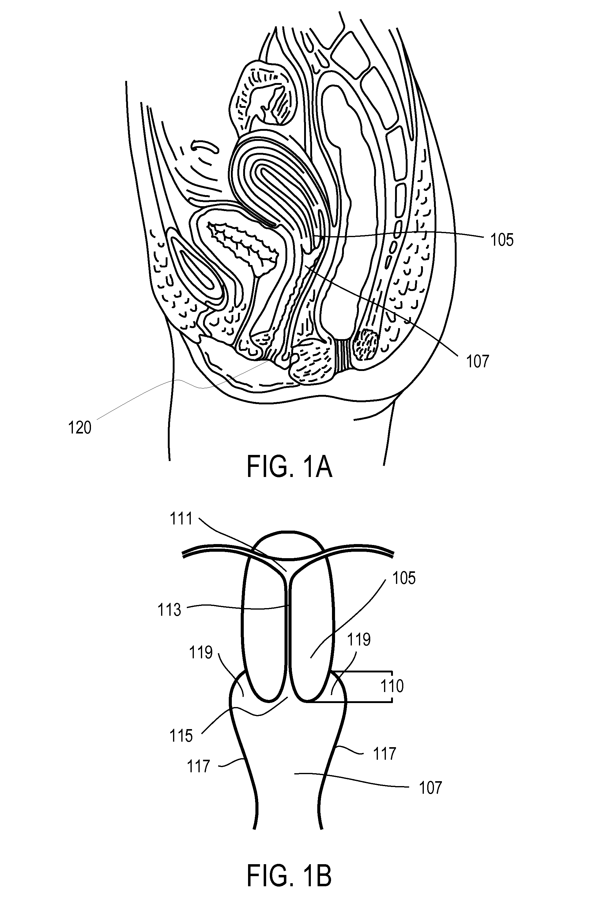 Therapeutic intra-vaginal devices and methods