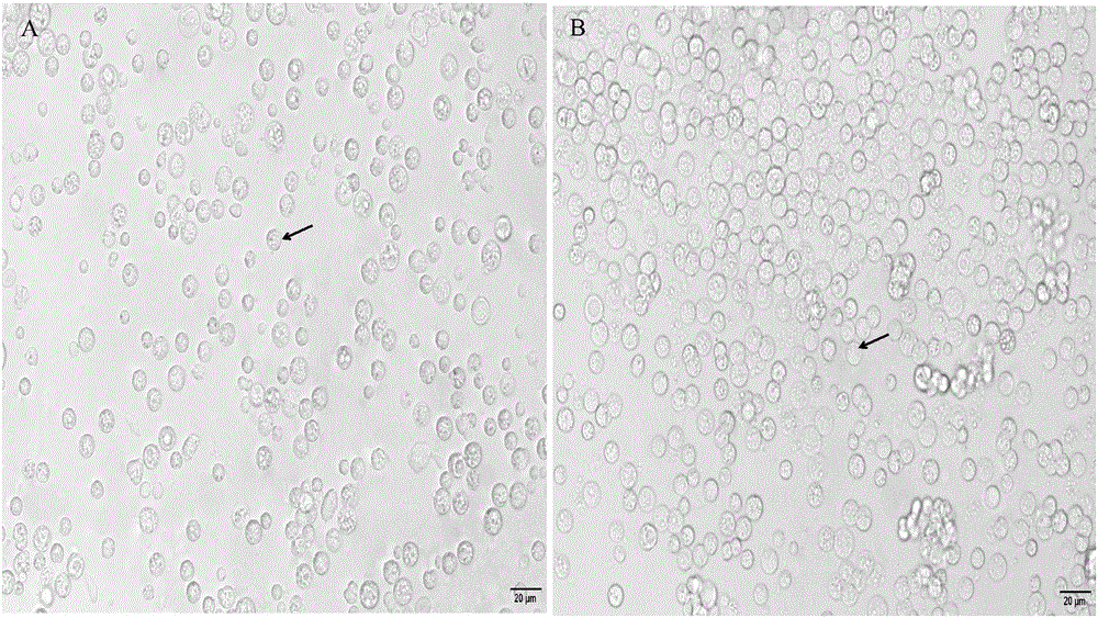 Separation, purification and primary culture methods of intestinal macrophages in Ctenopharyngodon idella