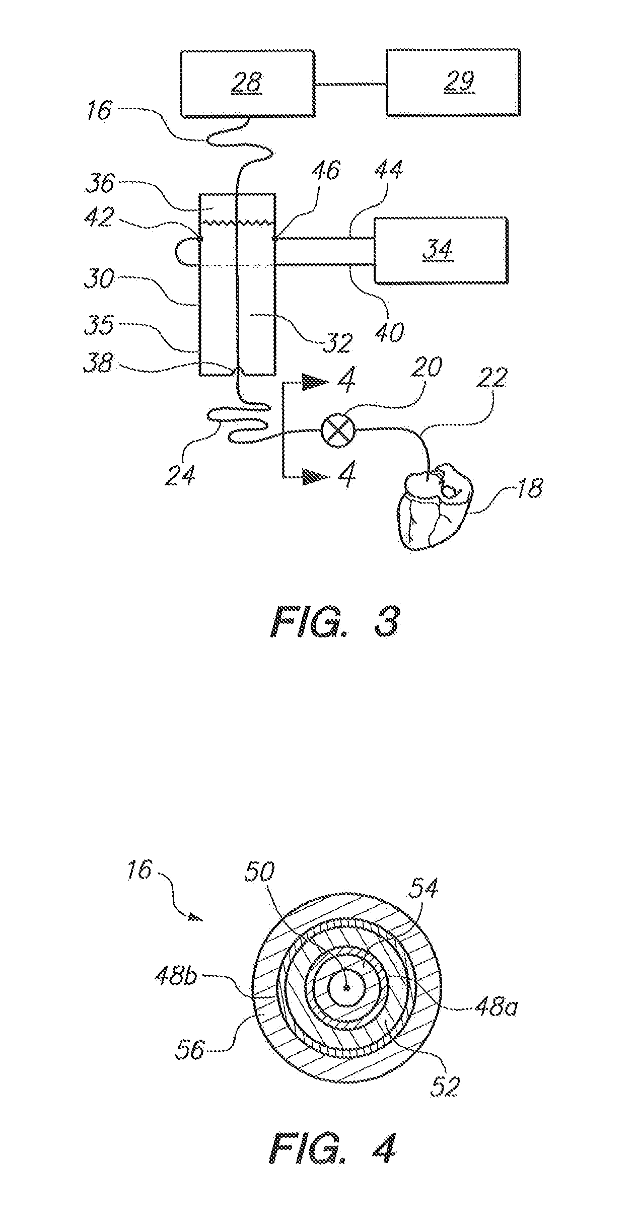 Extracorporeal Unit for Inspecting the Insulation of an Electrical Wire of an Implanted Medical Device