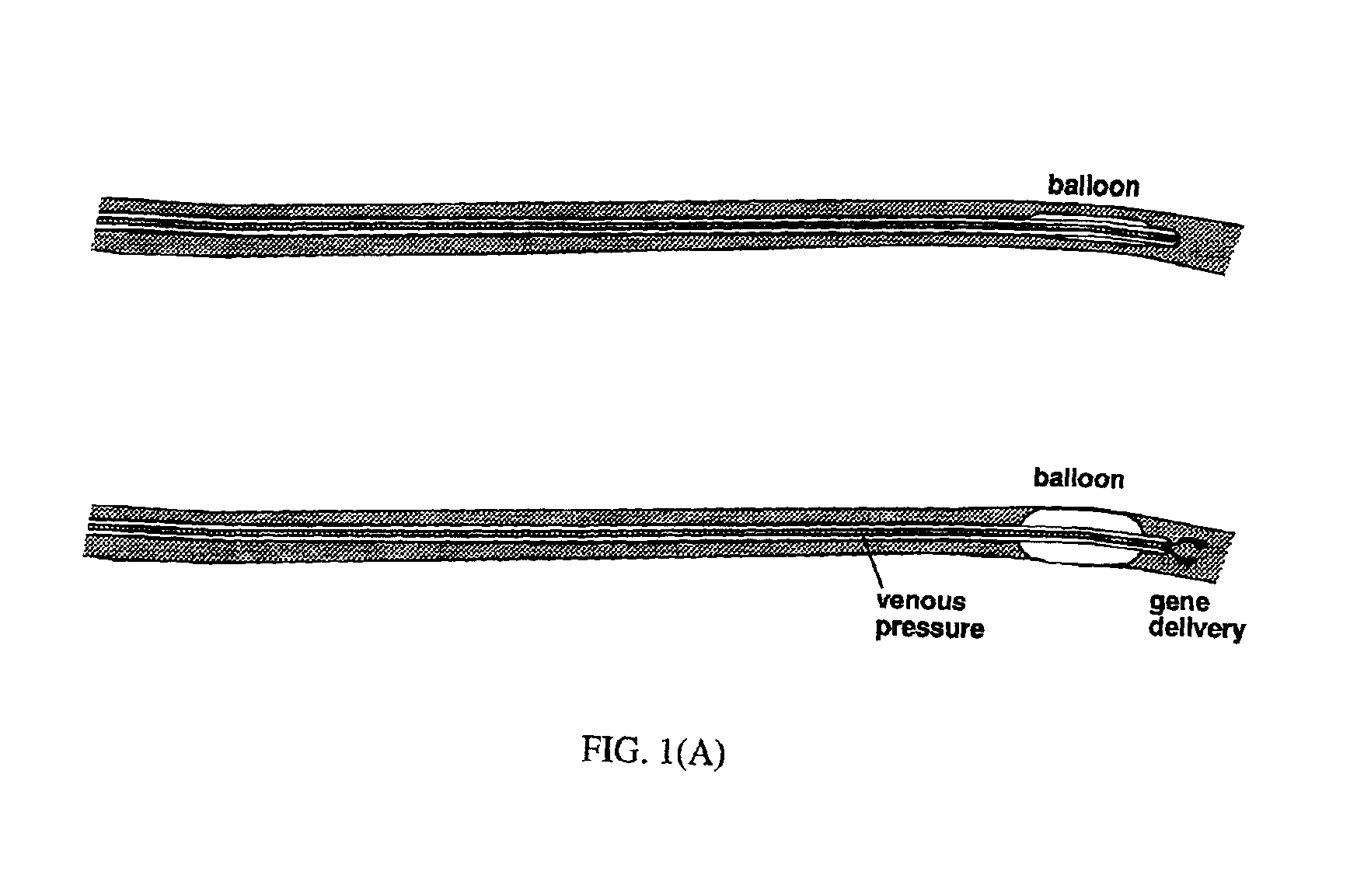 Process for delivering nucleic acids to cardiac tissue