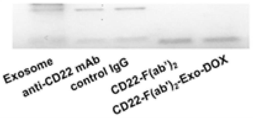 A kind of exosome targeting lymphoma cells and its preparation method and application