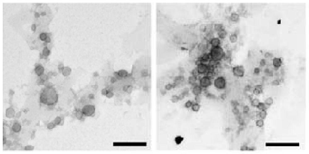 A kind of exosome targeting lymphoma cells and its preparation method and application