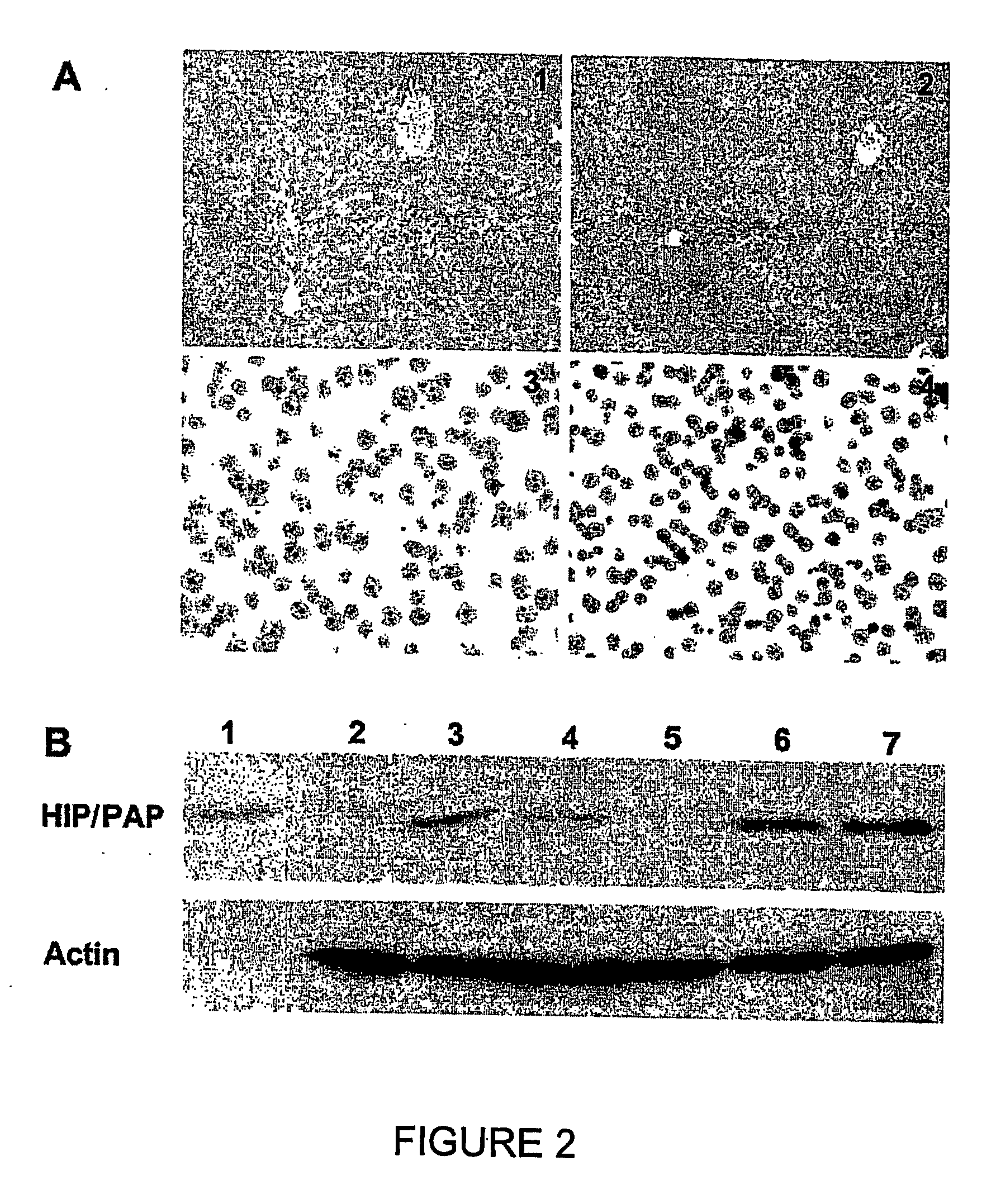 Hip/pap polypeptide compositions for use in liver regeneration and for the prevention of liver failure