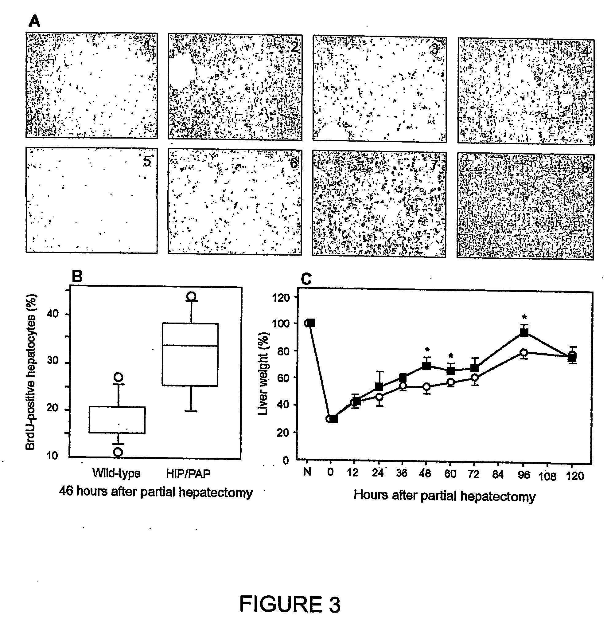 Hip/pap polypeptide compositions for use in liver regeneration and for the prevention of liver failure