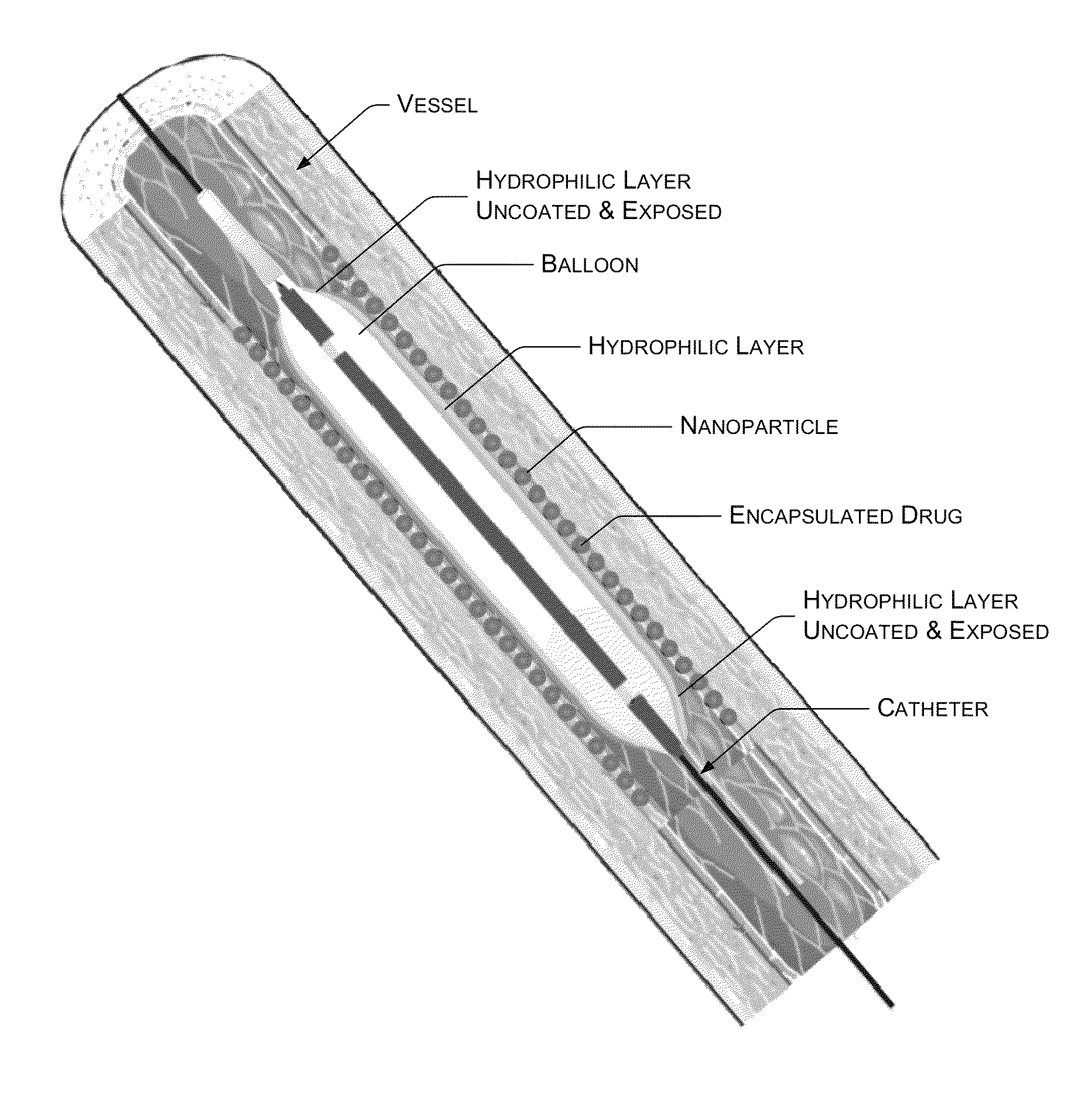 Balloon catheter providing decreased irritation and improved drug release and drug penetration