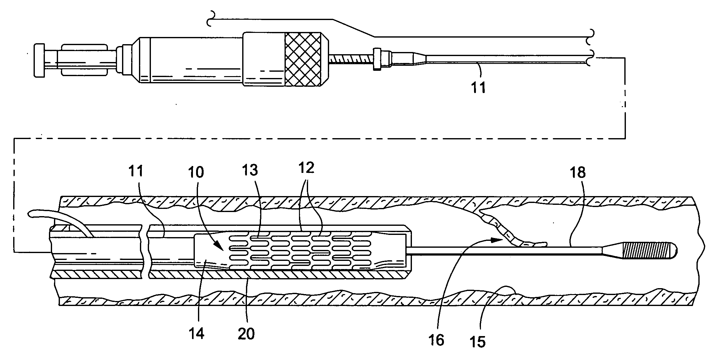 Stent crimping device