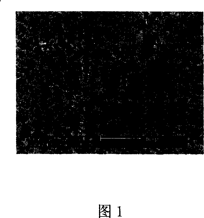 Nano lanthanum carbonate and orally disintegrating tablet and preparation method