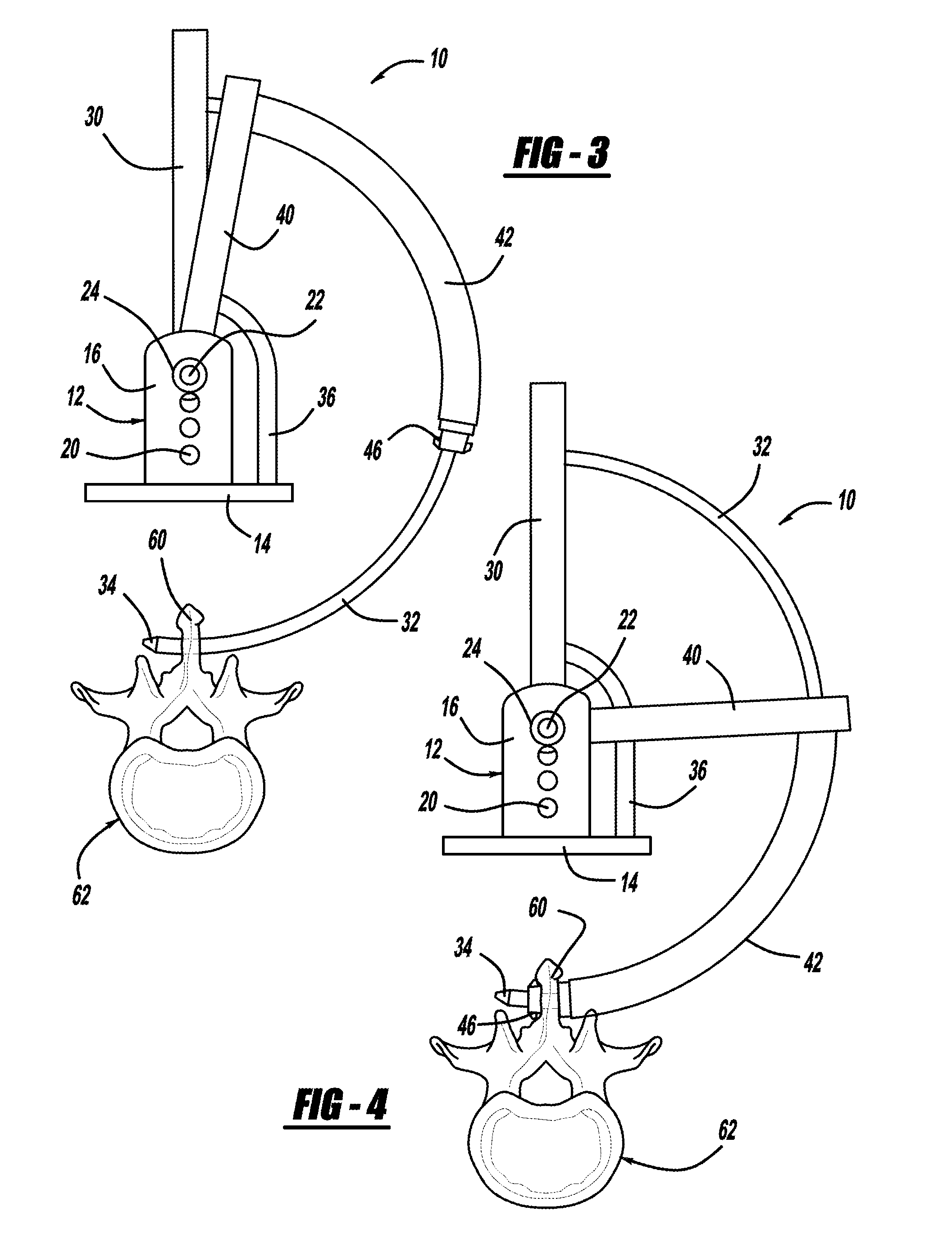 Interspinous process spacer device including a rotatable retaining member
