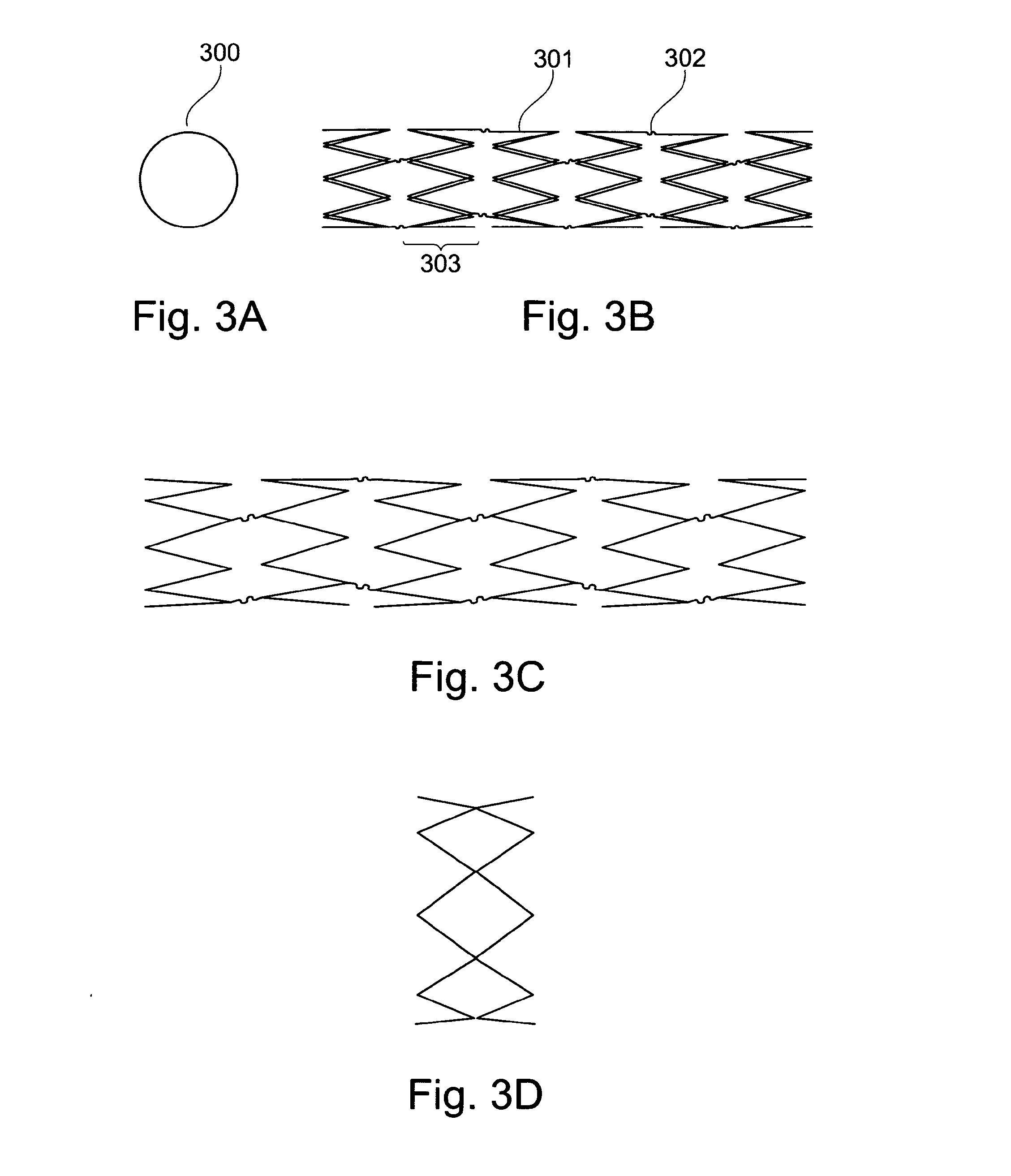 Device, And A Method For Treatment Of Increased Blood Pressure
