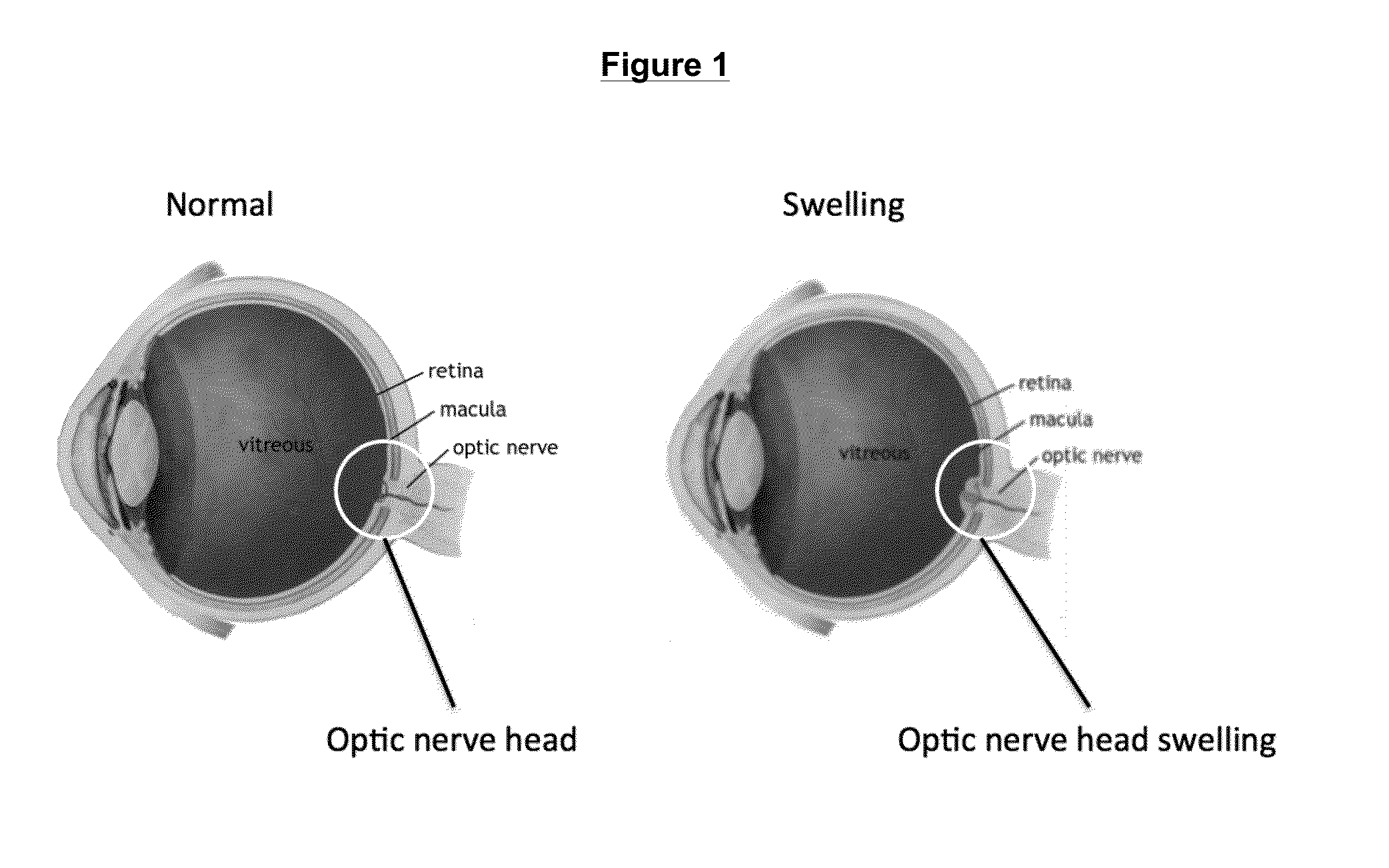 Method and System for Optic Nerve Head Shape Quantification