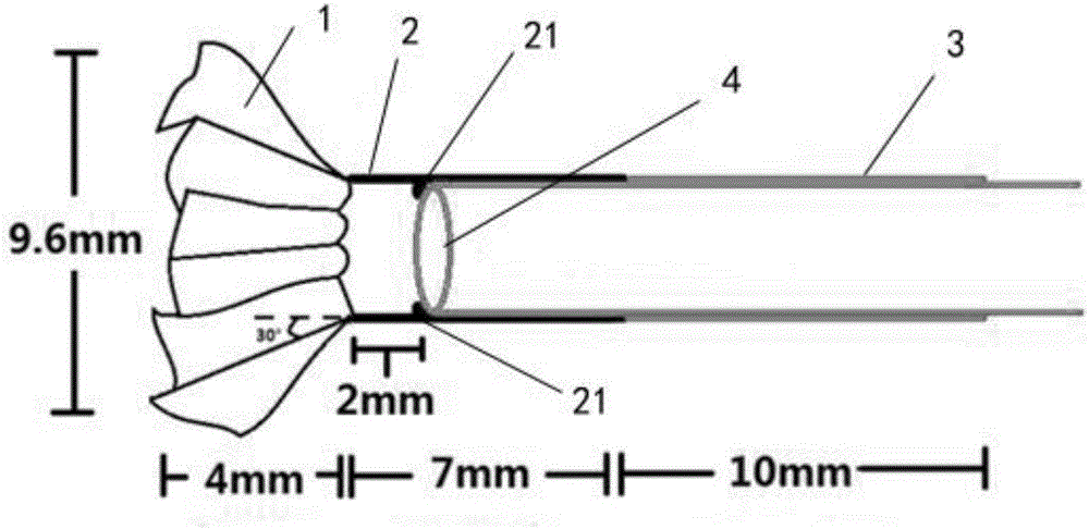 Auxiliary device for removing biliary calculi through negative pressure suction