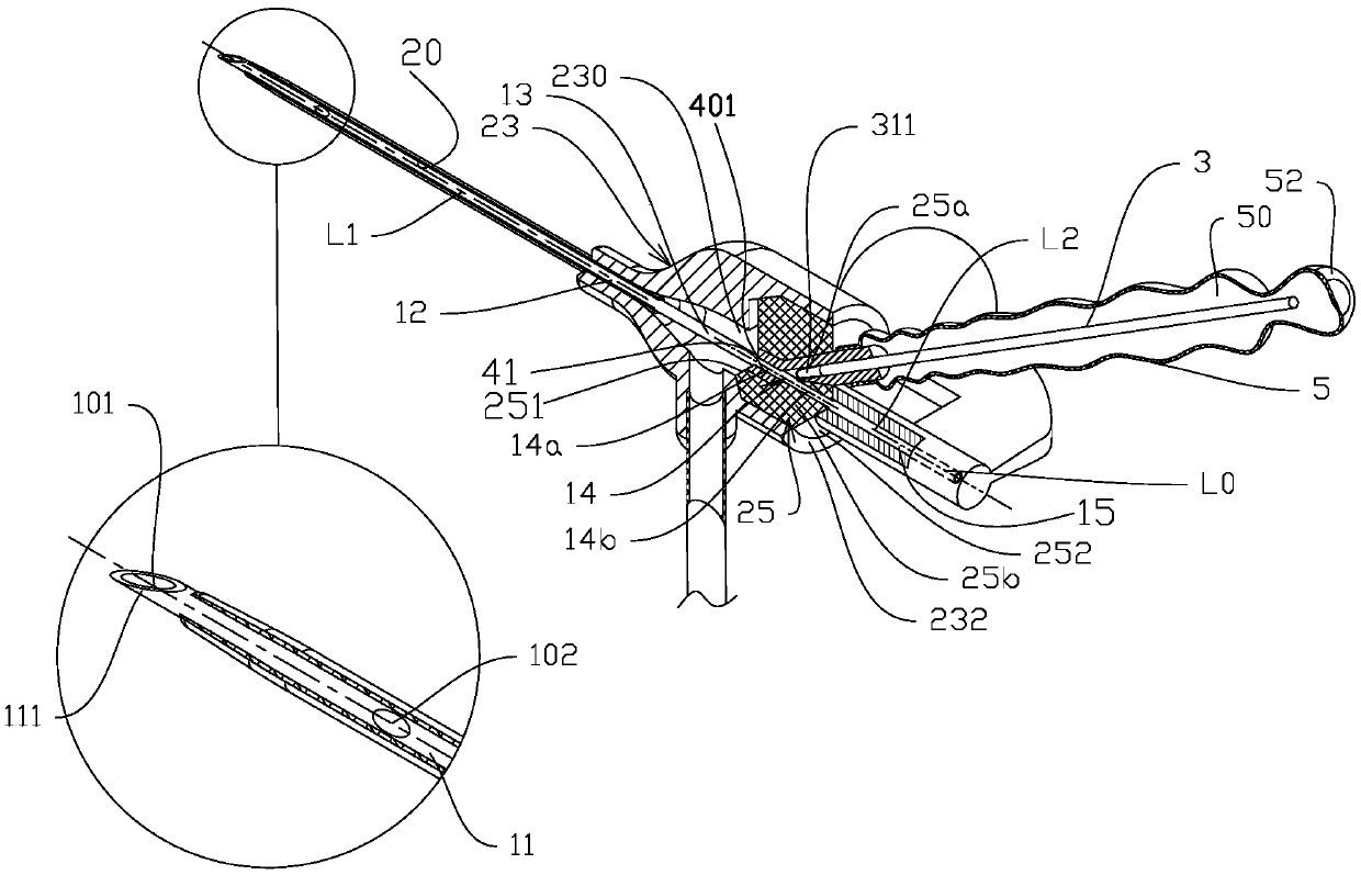 Vein duct device capable of performing plugging