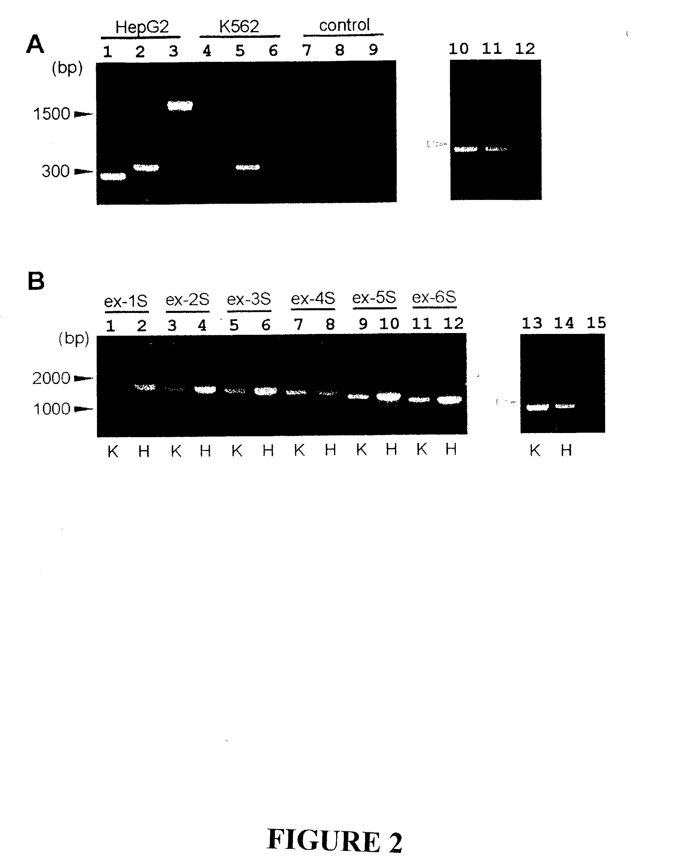 Variants of alpha-fetoprotein coding and expression sequences