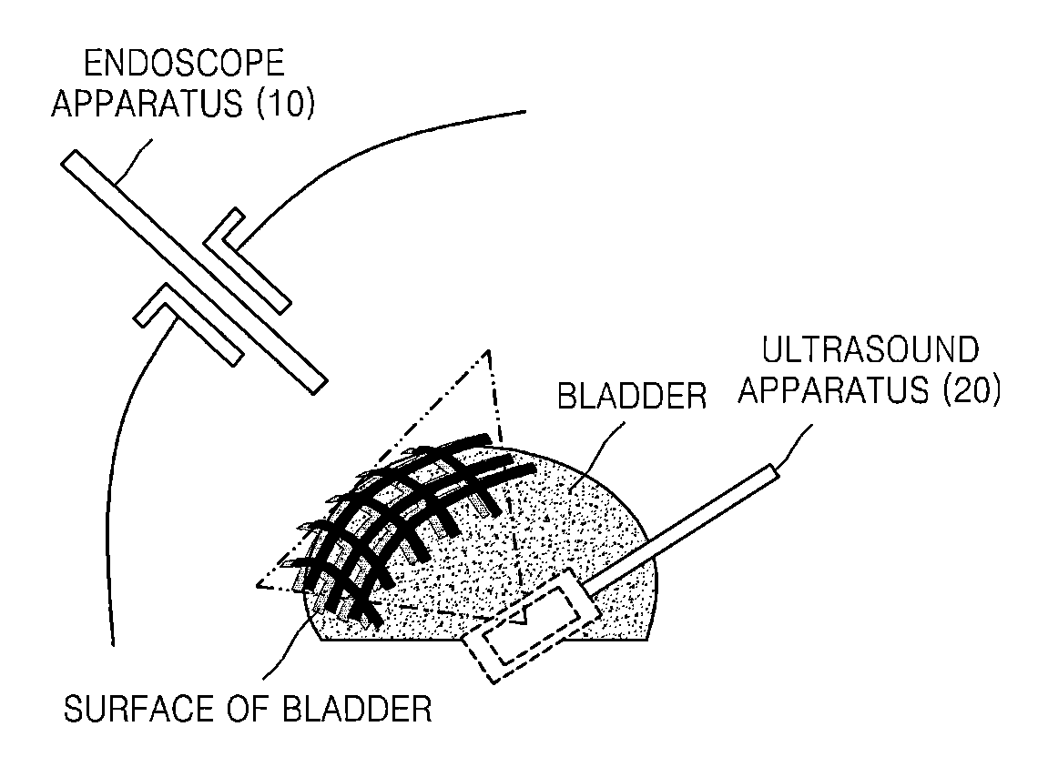Method and apparatus for processing medical image, and robotic surgery system using image guidance