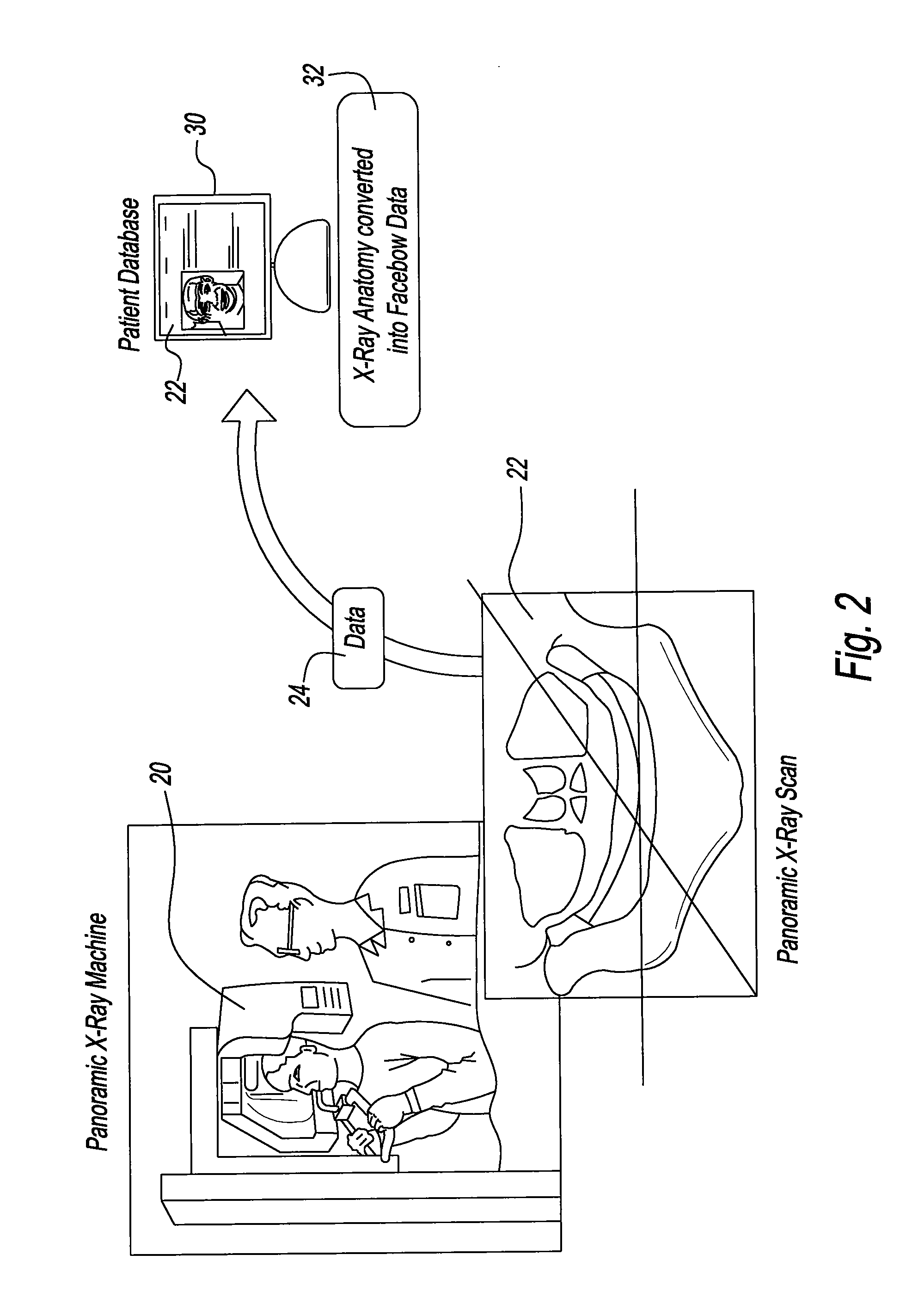 Method and Apparatus for Electronically Modeling and Manufacturing Dentures
