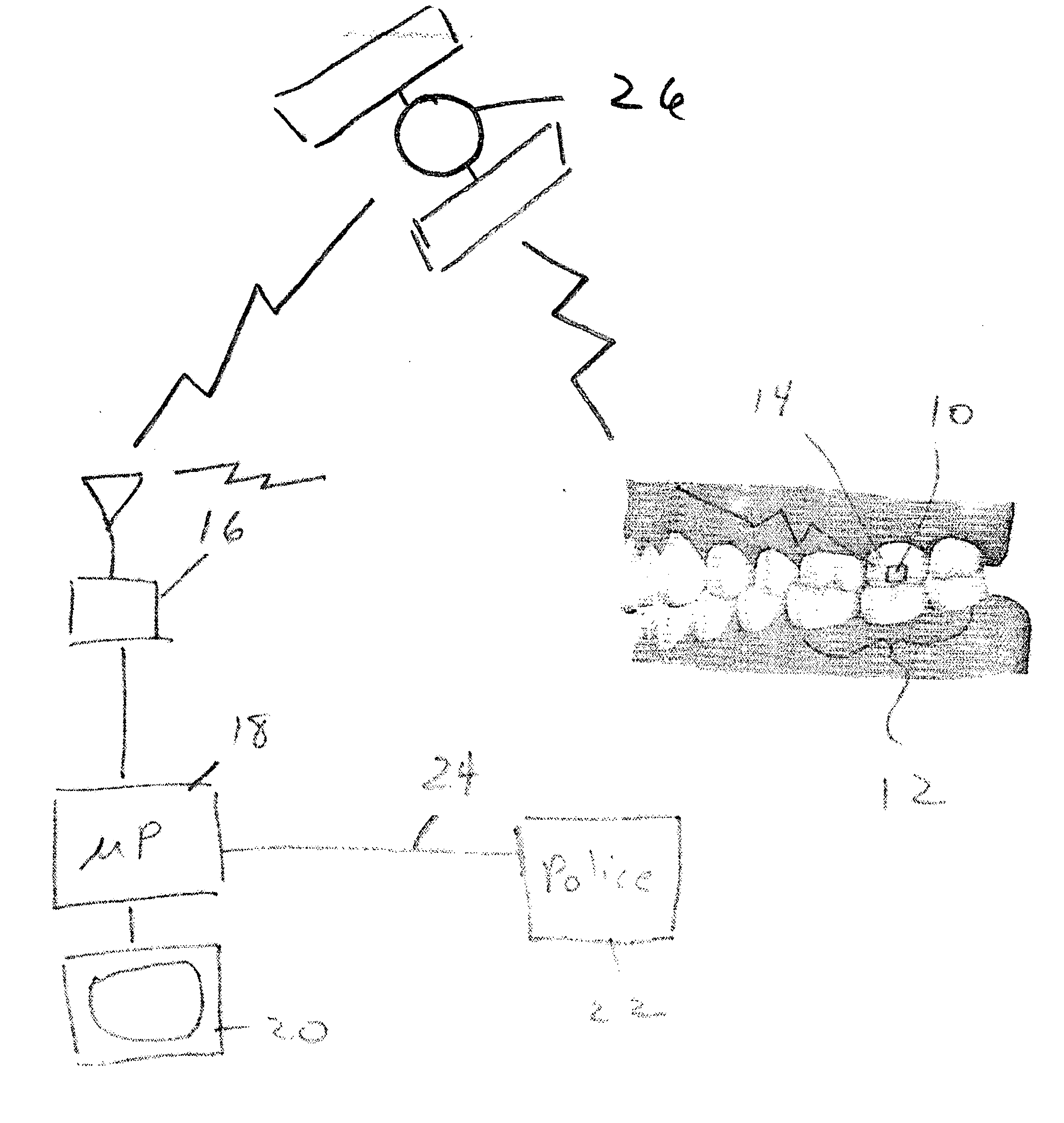 Dentally mounted RFID security device and method of using the same