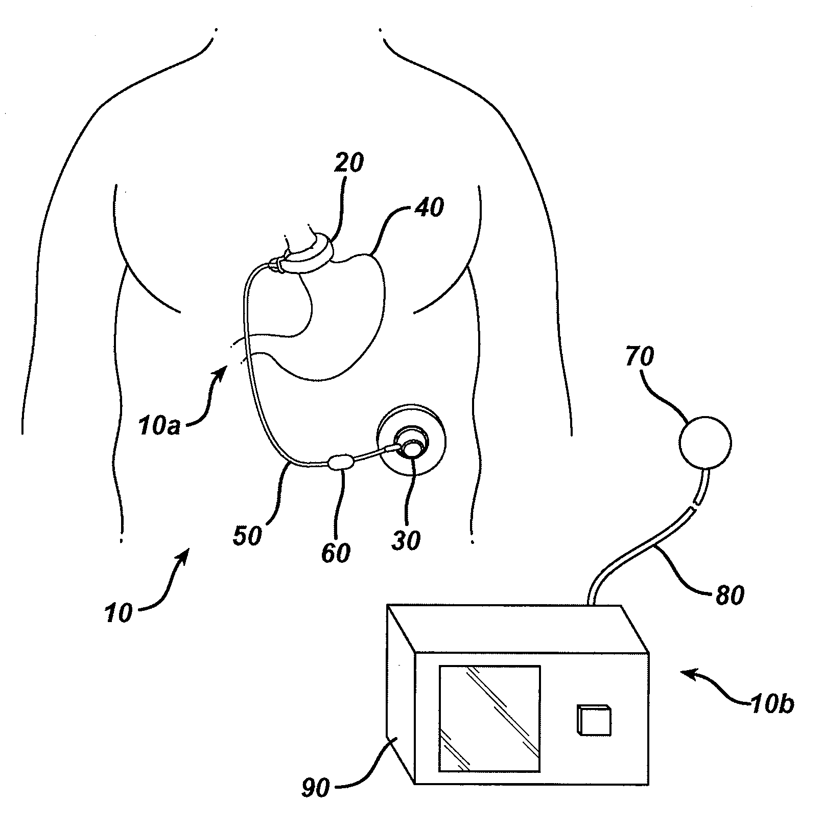 Gastric restriction device data handling devices and methods