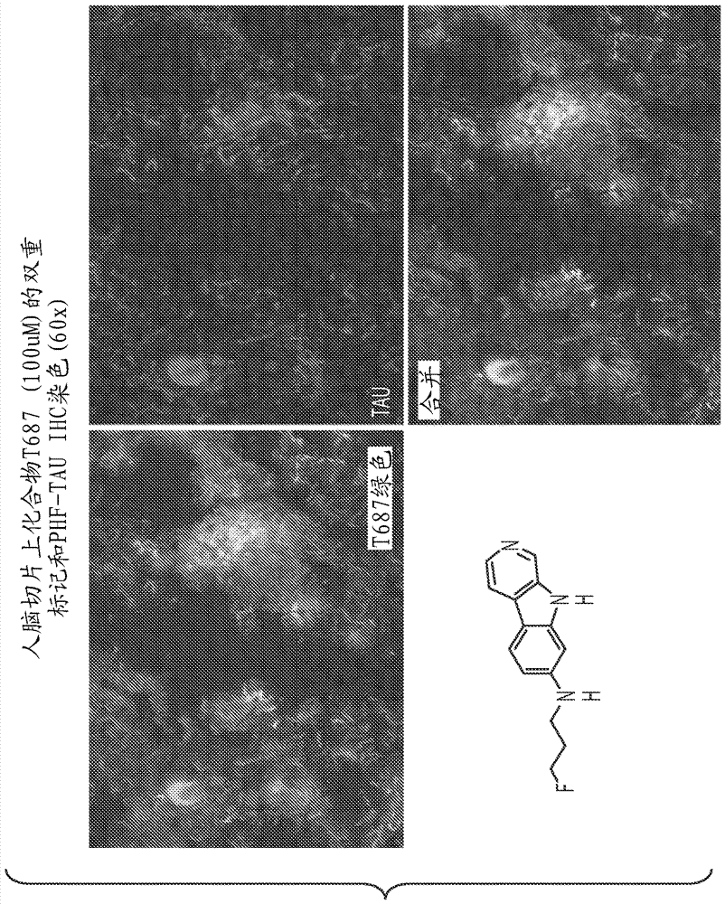 Carboline and carbazole based imaging agents for detecting neurological dysfunction