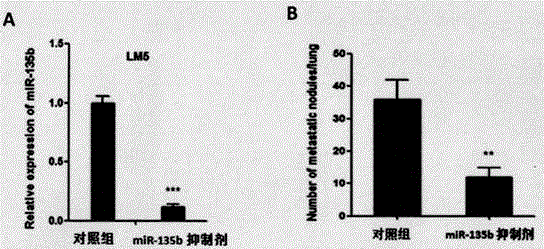 Application of miR-135b inhibitor to medicament for treating lung metastasis and relapse of osteosarcoma