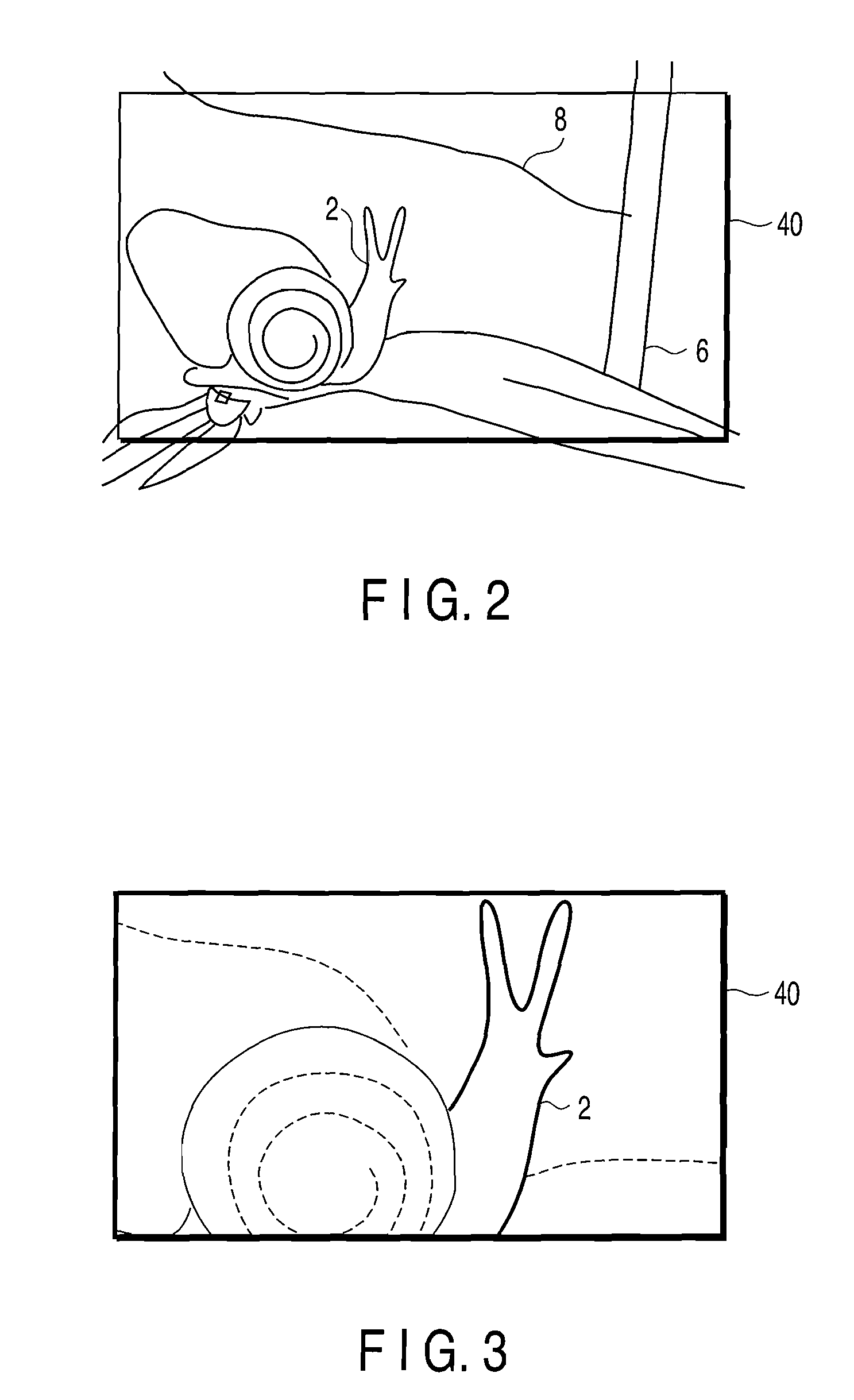 Imaging device