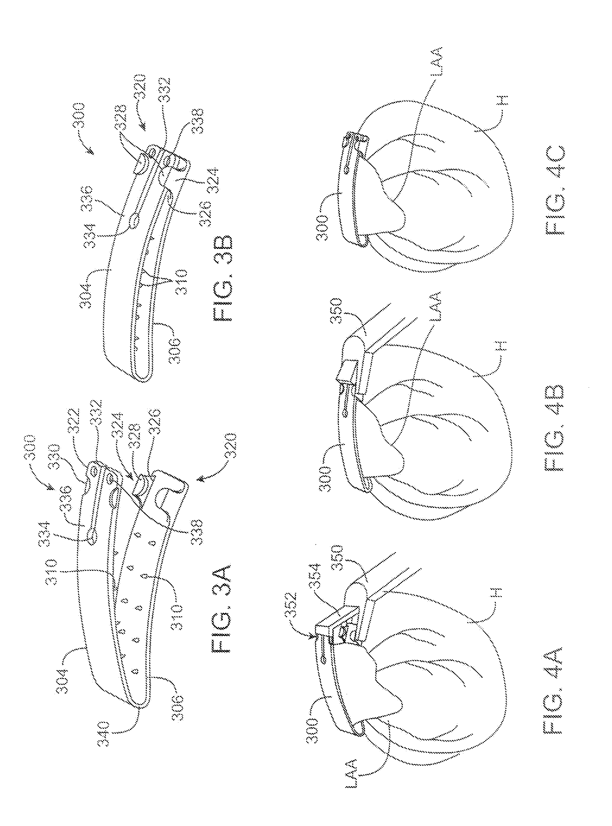 Left atrial appendage devices and methods