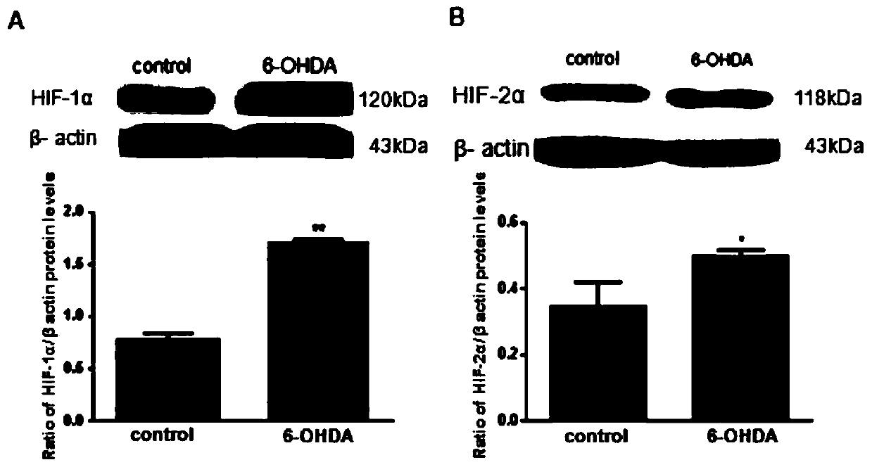 Application of hypoxia-inducible factor -2alpha as action target in prevention/treatment of Parkinson's disease