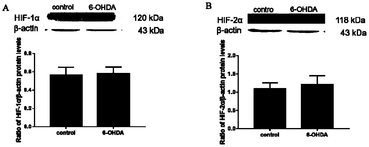 Application of hypoxia-inducible factor -2alpha as action target in prevention/treatment of Parkinson's disease