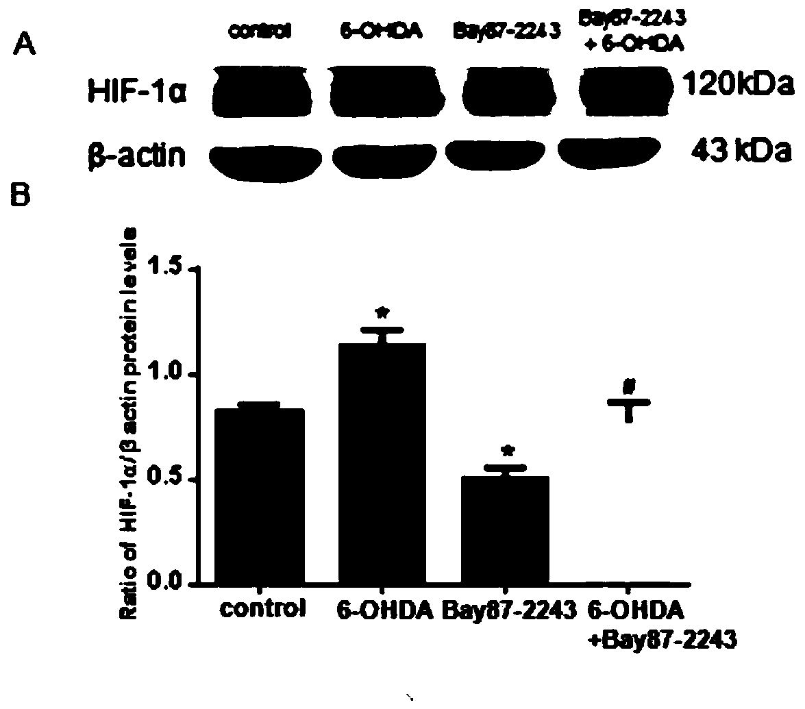 Application of hypoxia-inducible factor -2alpha as action target in prevention/treatment of Parkinson's disease