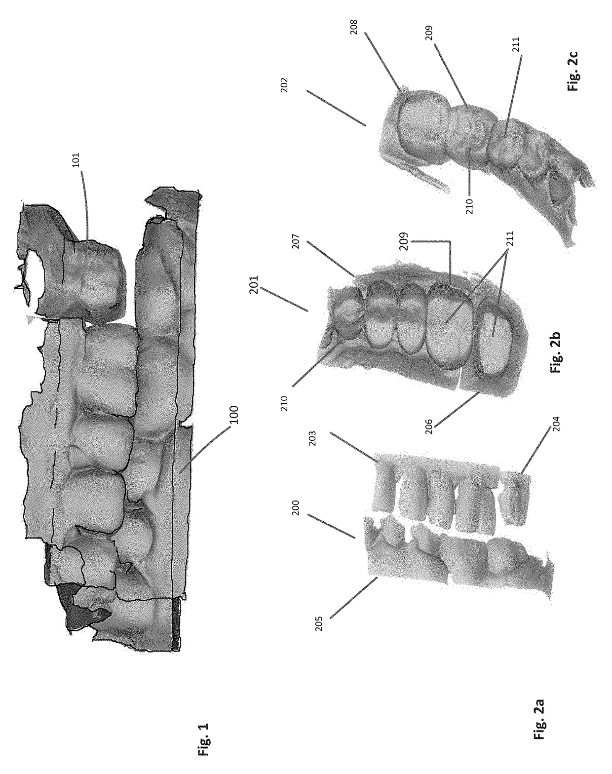 Method and Apparatus for Generation of 3D Models with Applications in Dental Restoration Design