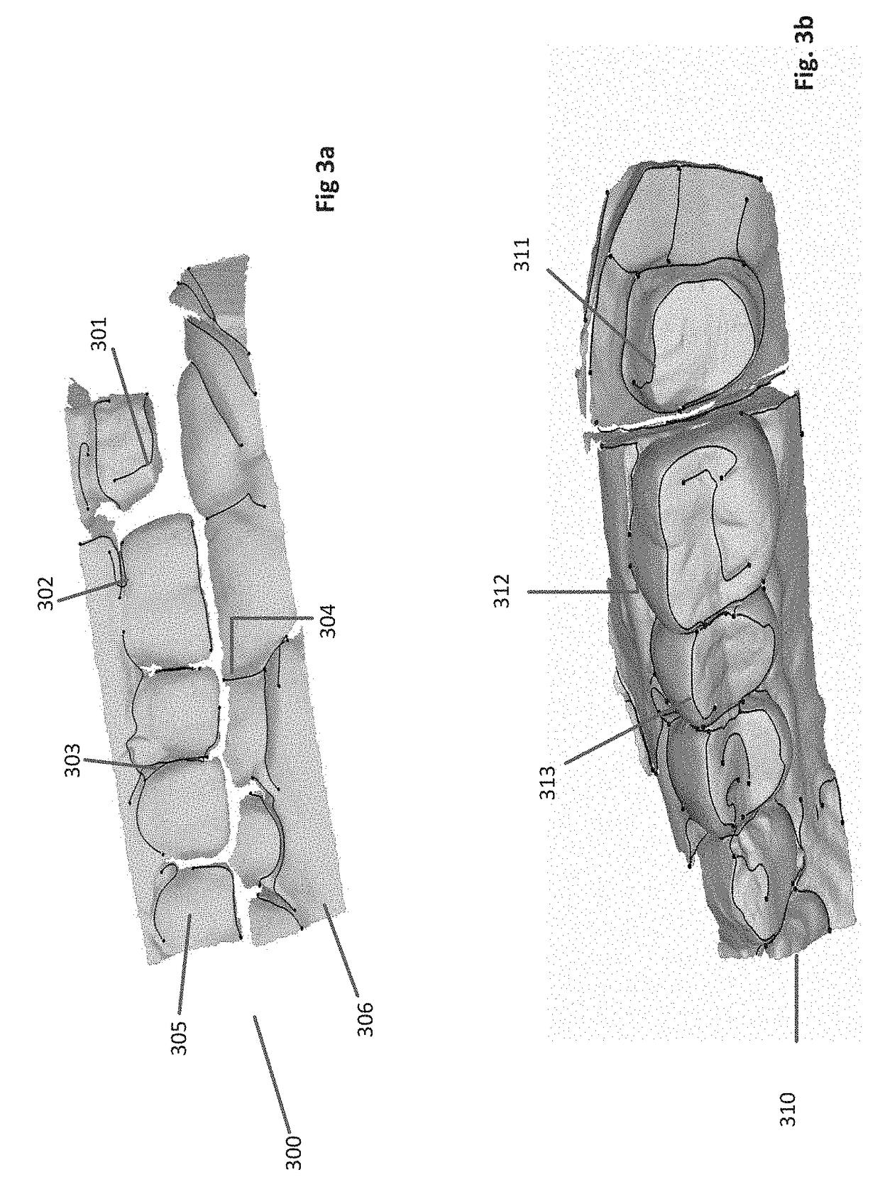 Method and Apparatus for Generation of 3D Models with Applications in Dental Restoration Design