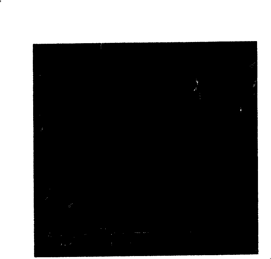 Method for preparing 3D porous bracket of chitosan ¿C copolymer of poly lactic acid