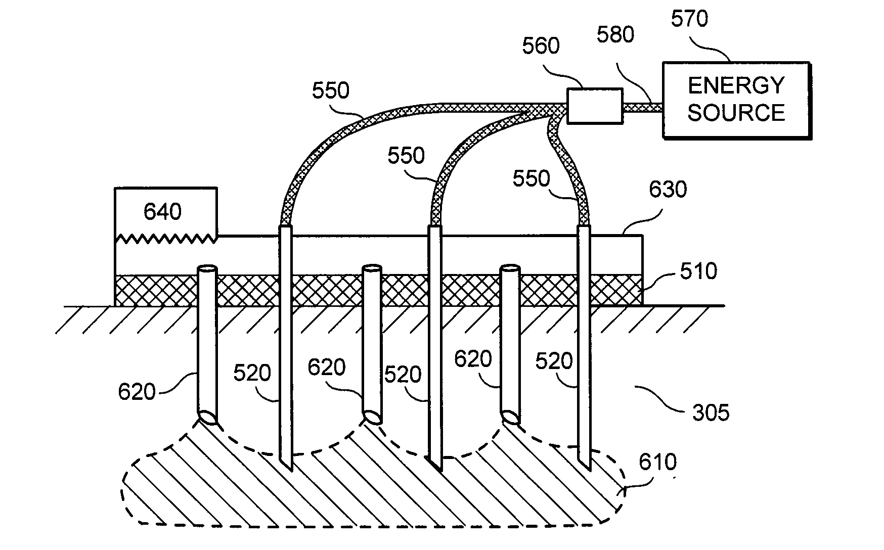 Method and apparatus for dermatological treatment and tissue reshaping