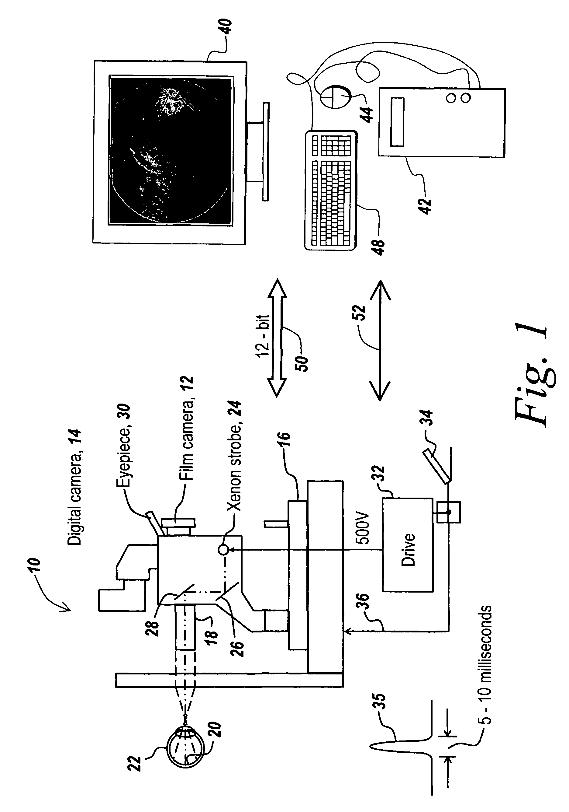 Haze reduction method and apparatus for use in retinal imaging